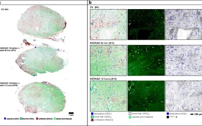 RRx-001, an epigenetic-based radio- and chemosensitizer, has vascular normalizing effects on SCCVII and U87 tumors