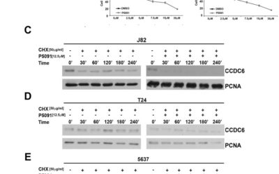 CCDC6 and USP7 expression levels suggest novel treatment options in high-grade urothelial bladder cancer.